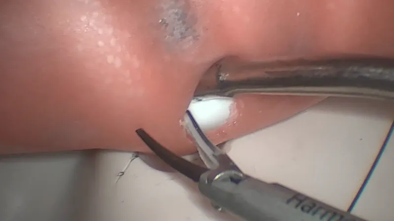 VATS dissection exercise setup