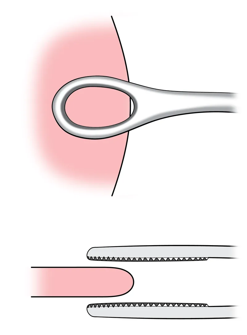 Perpendicular alignment